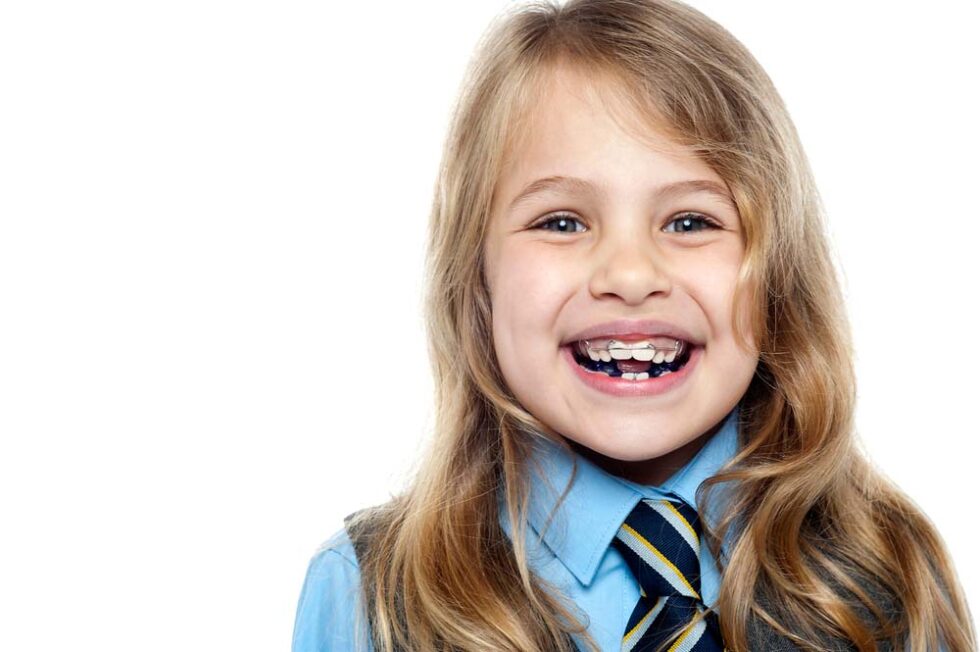 Braces for children Castle Orthodontics