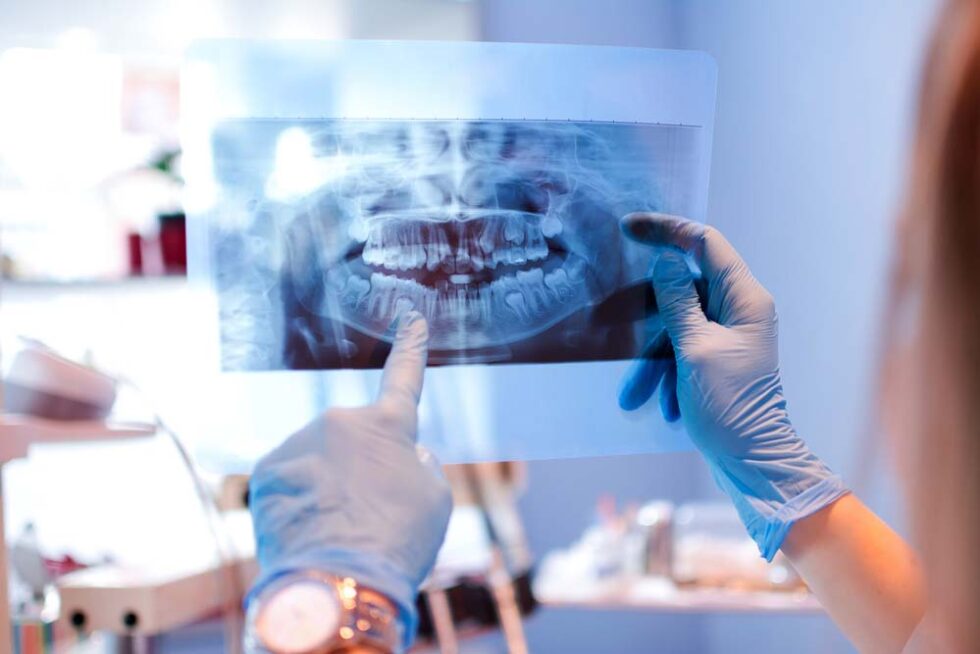 Who can benefit from orthodontics? Castle Orthodontics